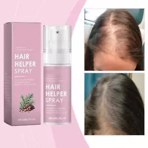 Hair Helper Spray, Hair Helper Growth Spray, Hair Growth Serum 2025 Lot D2 - Picture 1 of 18