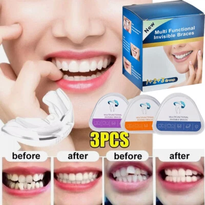 3 Stage Dental Orthodontic Teeth Corrector Braces Tooth Retainer Straighten Set - Image 1 of 4