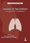 Clinical Focus Series: Lesions of Sarcoidosis: A Problem Solving Approach by Om 