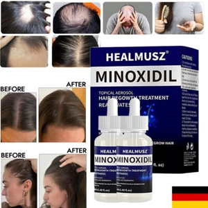 50ml HEALMUSZ Haarwuchs-Serum - Stoppt Haarausfall & Stimuliert Nachwachsen - Bild 1 von 23
