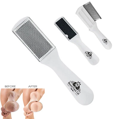 Double Sided Foot File Feet Rasp Pedicure Scrubber Hard Dead Skin Callus Remover - Image 1 of 4