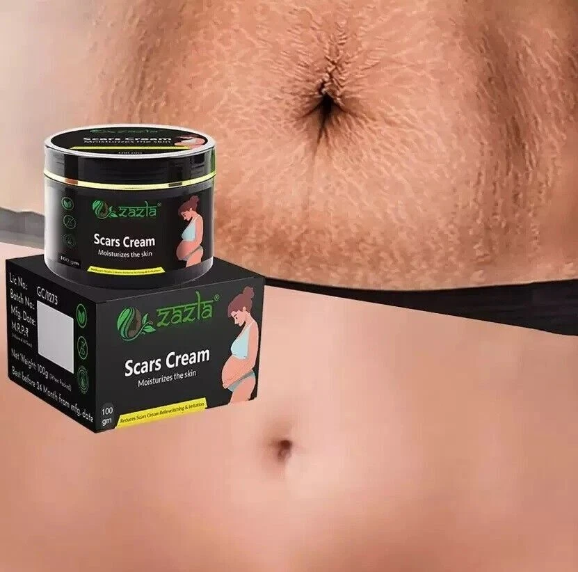 Best Scar Removal-Cream for Old-Scars Stretch Mark Removal Cream UNISEX 100gm - Image 1 of 4