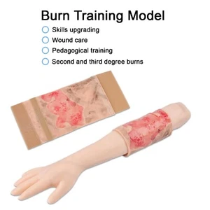 Gliedmaßen Verbrennung Trainingsmodell, Realistisches Wundsimulationsmodul, Medizinische Erste Hilfe - Bild 1 von 7