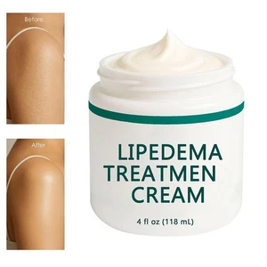 Lipedema Treatment Cream for Lipedema, Cellulite and Stretch Marks GX - Picture 1 of 13