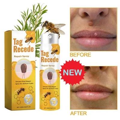 MARKENLOS 20ml Bee Warze Entfernung Pflege Spray 2025 HOT
