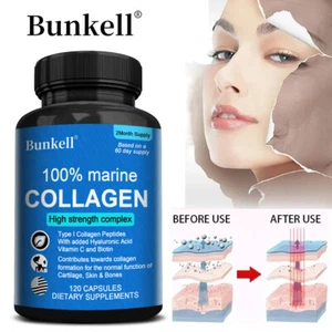 Kollagen Kapseln - 1200mg Marine Collagen - 30/60/120 Capsules -Hyaluronsäure - Bild 1 von 13