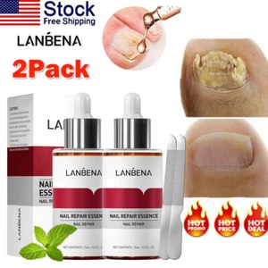 2 Stück Nagelpilz Reparatur Essenz Serum + Nagelfeile Hand Füße Behandlung Nagelreparatur - Bild 1 von 13