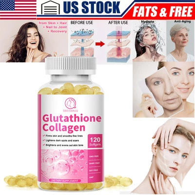 L Glutathione Collagen Skin Whitening Lightening Dark Spots Skin Bleaching 120 - Image 1 of 4