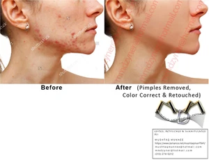 Retoque facial (espinillas eliminadas, color correcto y retocado) - Imagen 1 de 1