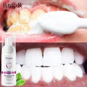 Teeth Cleansing Stains Oral cleaning Teeth whitening Remove tooth stains Oral Hy - Picture 1 of 4