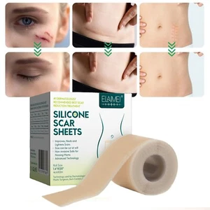 Surgery Scar Removal Sticker Sheet Patch Silicone Gel Scars Treatment Efficient - Picture 1 of 12