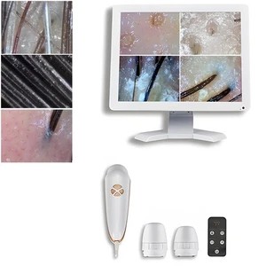 Detector de cabello de piel de 15,6 pulgadas escáner facial de alta precisión para uso profesional - Imagen 1 de 4