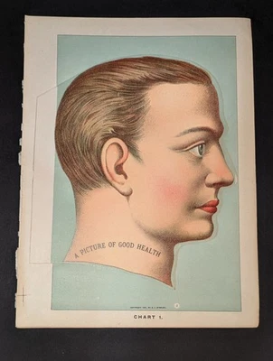 Antique Medical Book Plate A Picture of Good Health Layered Anatomy E J Stanley - Image 1 of 4