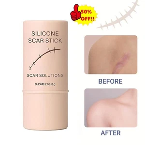 Silicone Scar Stick Scar Solutions 6.8g Scar Repair Cream IN STOCK - Picture 1 of 13
