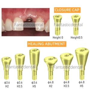 NC Dental Healing Abutment Healing Closure Narrow Fits Straumann ITI Bone Leval - Picture 1 of 9