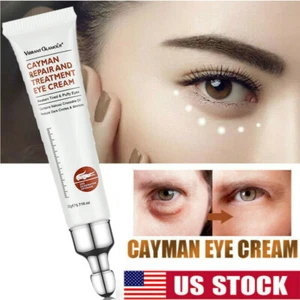 Eye Cream Remover Dark Circles Puffiness Wrinkles Bags Anti-Aging Eye Serum ๐ฅ - Picture 1 of 11