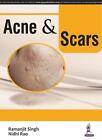 Acne & Scars by Ramanjit Singh (English) Paperback Book