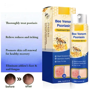 Bee Venom Psoriasis Treatment Spray, Psoriasis Relief Soothing Spray20ML - Picture 1 of 5