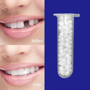 Dental Filling Temporary Tooth Fix Chipped Teeth, Gaps in Teeth False teeth 20g - Picture 1 of 17