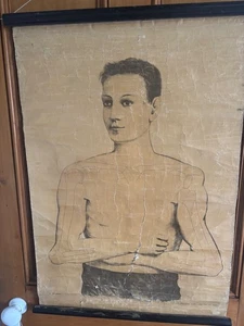 Vintage wall chart showing shoulder dislocation. - Picture 1 of 5