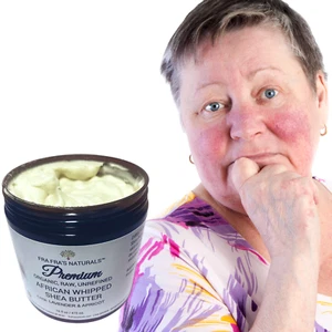 Fra Fra's Naturals | Premium EXTREME Healing Rosacea Whipped Shea Butter Blend - Picture 1 of 4