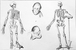 SQUELETTE de CHIMPANZÉ & SQUELETTE HUMAIN + TÊTE d'ORANG-OUTAN ROUX- Gravure 19e - Picture 1 of 2