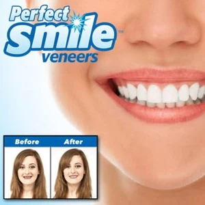 Dent de remplacement Perfect Smile réutilisable amovible pose instantanée