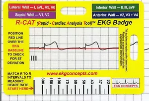 R-CAT EKG Badge Card – Accurately Interpret ECG/EKG Rhythm Strips and 12 Le... - Picture 1 of 9