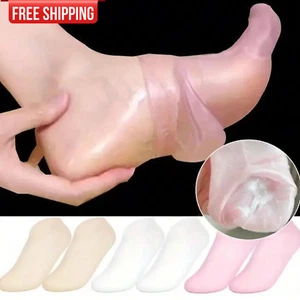 2Pcs Silicone Moisturizing Foot Socks For Dry Cracked Heel Feet Foot Care Socks - Picture 1 of 13