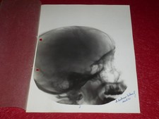 [photography x-ray radiographs] signed ledoux-lebard 1931 cabinet curiosities 4