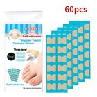 Nail Correction Stickers Ingrown Toenail Corrector Patches Treatment Recover 60x