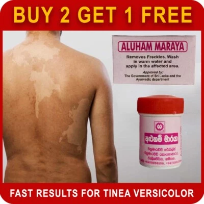 TINEA VERSICOLOR ANTIFUNGAL Relief Pityriasis versicolor Skin Rash Disease Cream - Image 1 of 3