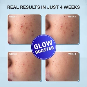 DERMDOC 2% Kojic Acid Night Cream (50g) Face Moisturizer For Brightening Skin - Picture 1 of 7