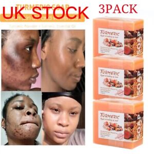 UK 3Pack Tumeric Soap Acne Dark Spots Remove Skin Whitening Body Soaps 