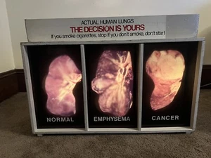 Vintage Optiscope Lung Display Anti Smoking - Picture 1 of 7