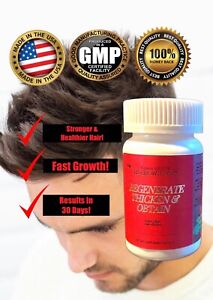 Minoxidin1000mg Hair Growth Formula Extra Strength BIOTIN  Regrowth Pills 60ct