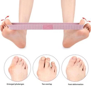 2pcs Bunion Corrector Band for Big Toe Stretching - Stretching Foot Ca3d8 - Picture 1 of 19