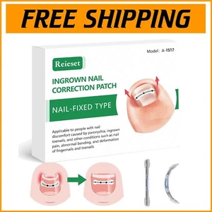 Curved Nail Repair Kit with Long-Lasting Titanium Alloy Ingrown Toenail Solution - Picture 1 of 8