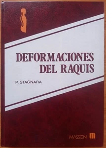DEFORMACIONES DEL RAQUIS ,Escoliosis, Cifosis y Lordosis ,P. STAGNARA,1987 - Imagen 1 de 5