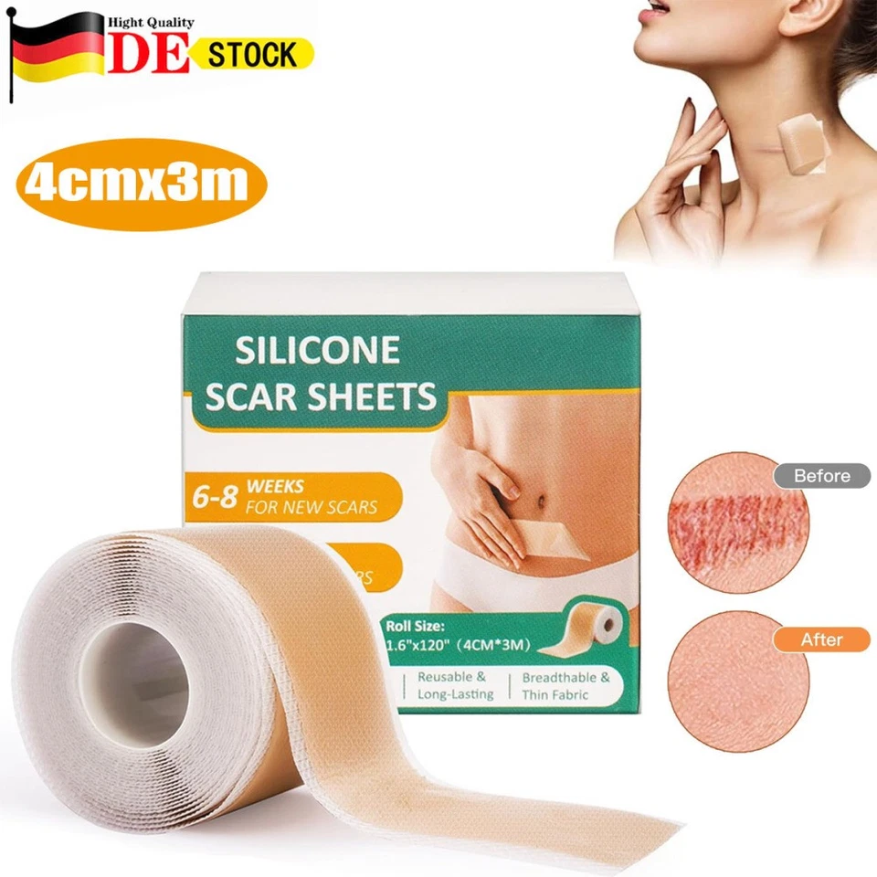 MARKENLOS Narbenpflaster Silikonpflaster Narben Reduktion Silicone Scar Sheets 4cmx3m DHL