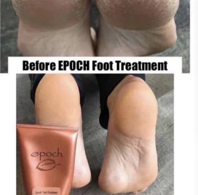 NUSKIN Epoch Sole Solution Foot Treatment 4 Oz