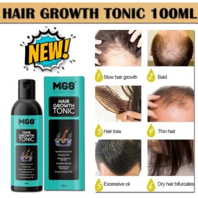 Magic hair growth tonic best hair loss treatment for men, Hair Grow Fast 100ml - Image 1 of 4
