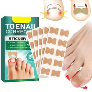 50pcs Ingrown Toenail Correction Stickers Hands Feet Soft Nail Inlaid Care Patch - Picture 1 of 8