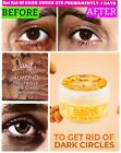 Janat Almond Under Eye Dark Circle Remover cream 50g. magic wrinkle eye cream.