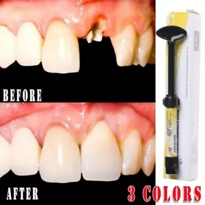 Composite Dental Cement Dental Care Resin Teeth Restoration - Picture 1 of 10