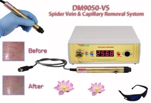 Laser spider capillary vein reduction removal kit for legs face nose & body. - Picture 1 of 4