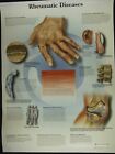 Rheumatic Diseases wallchart poster 500 x 670mm NEW medical educational