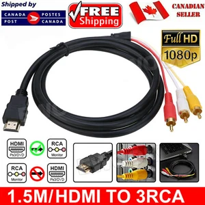 HDMI Male to 3 RCA RGB Male AV Video Audio Adapter Cable For HDTV DVD Player - Picture 1 of 11