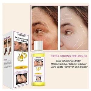 Extra Strong Yellow Peeling Oil Dark Skin Body Bleaching Brightening  FAST - Picture 1 of 12