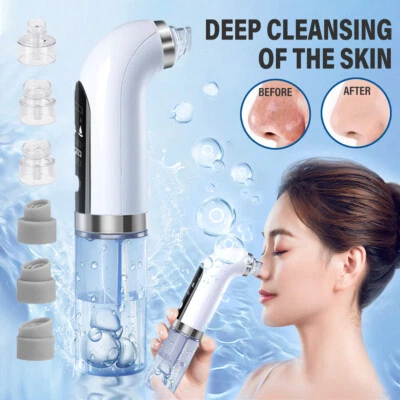 Vacuum Blackhead Remover Skin Pimple Suction Cleaner Pore Acne Cleansing Machine - image 1 of 4
